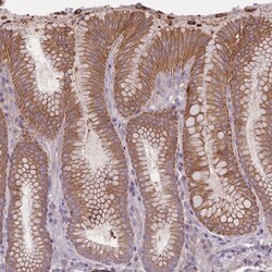 HSBP1L1 Antibody, Novus Biologicals 0.1mL; Unlabeled:Antibodies, Polyclonal
